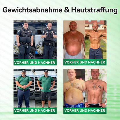 🔥🔥 Kaufen Sie mehr als 10 Packungen und sparen Sie 30%! GLORENDA® Mikronadel-Pflaster sind sicher und getestet. Mit 4–6 Packungen unterstützen Sie Gewichtsmanagement, Blutzuckerregulation, Verdauungsgesundheit und langanhaltende Energie!
